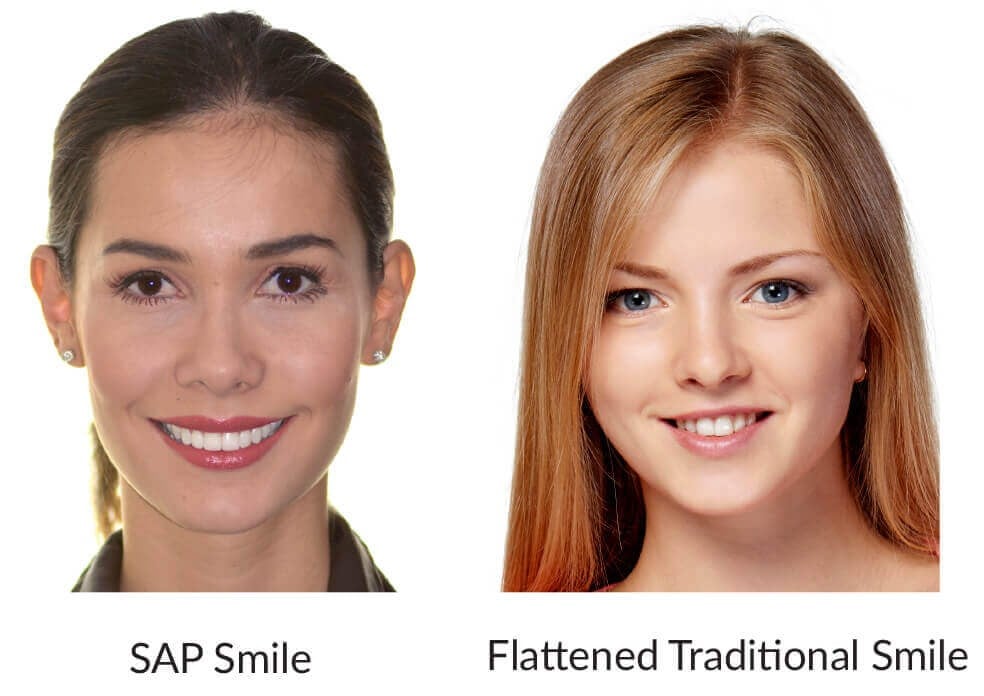 Achieve Beautiful Smile with Orthodontic Treatment